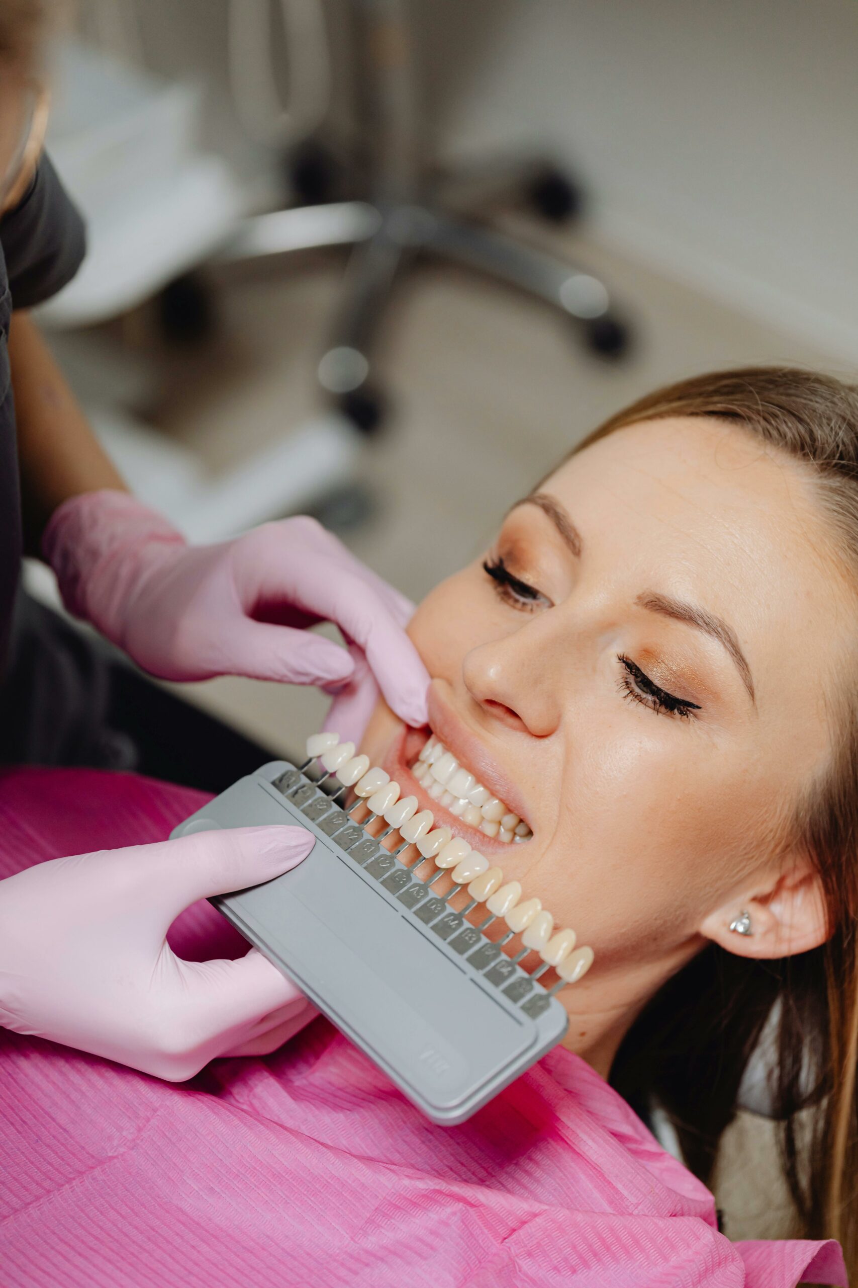 Dental Veneers
