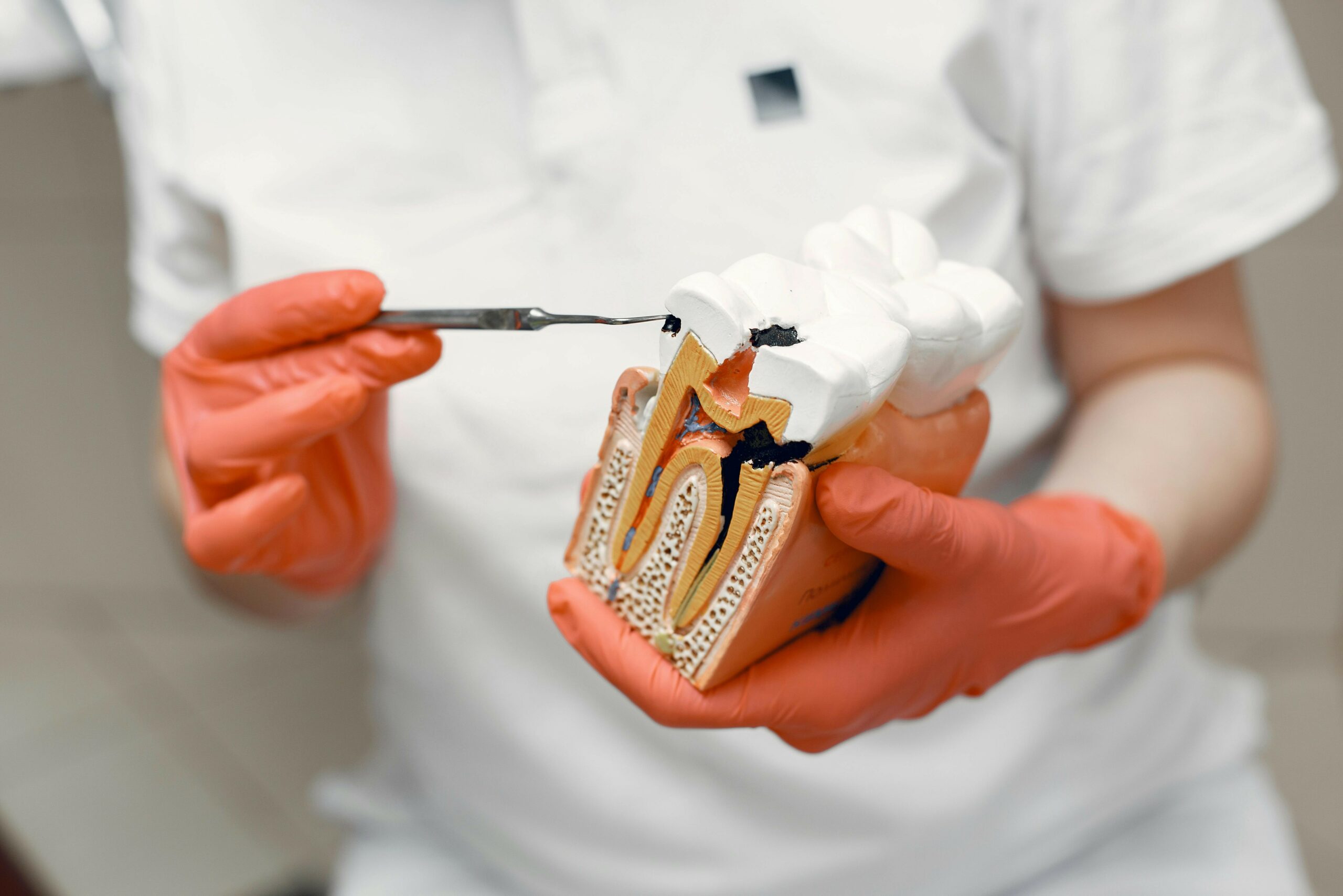 Root Canal Procedure