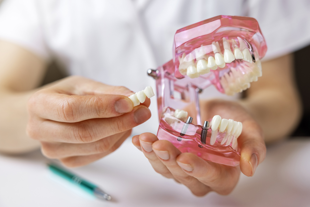 Hainesport Dental Implants